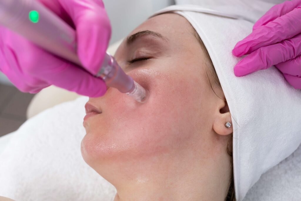 A woman getting microneedling treatment